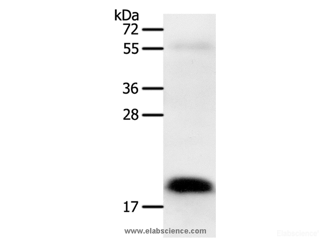 Western Blot analysis of Human colon cancer tissue using PTN Polyclonal Antibody at dilution of 1:600