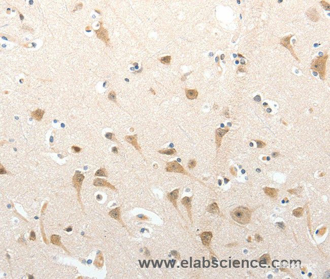 Immunohistochemistry of paraffin-embedded Human brain tissue using SEMA3D Polyclonal Antibody at dilution 1:50
