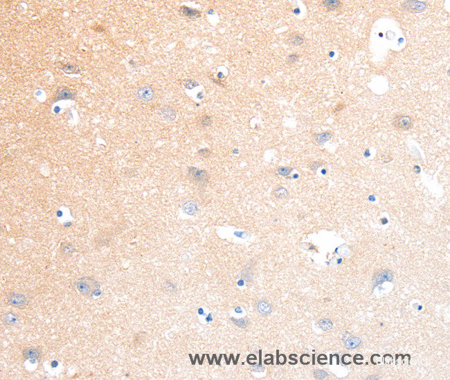 Immunohistochemistry of paraffin-embedded Human brain tissue using SLC22A17 Polyclonal Antibody at dilution 1:40