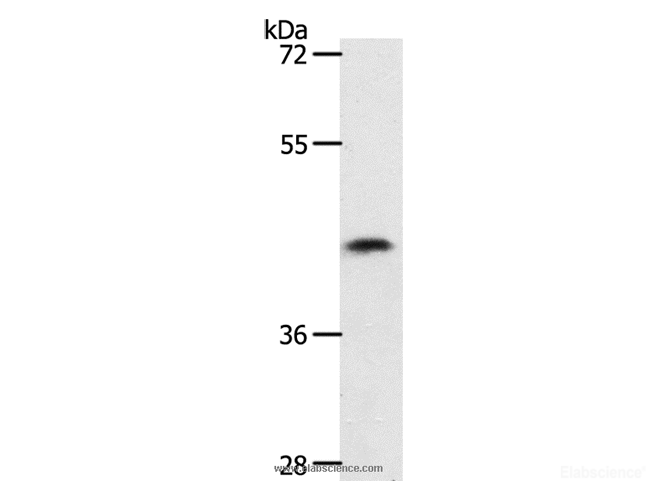 Western Blot analysis of 231 cell using PLAT Polyclonal Antibody at dilution of 1:450