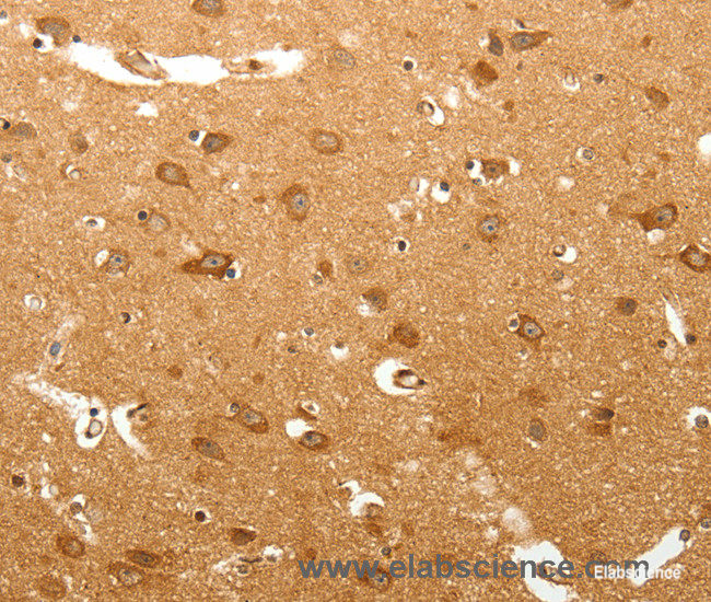 Immunohistochemistry of paraffin-embedded Human brain tissue using MAP1B Polyclonal Antibody at dilution 1:60