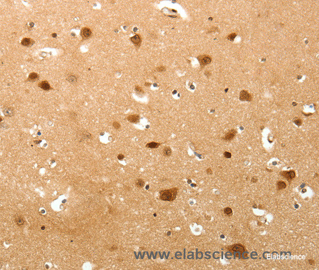 Immunohistochemistry of paraffin-embedded Human brain tissue using TNN Polyclonal Antibody at dilution 1:40