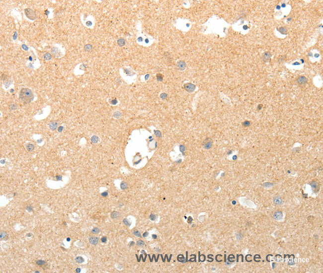 Immunohistochemistry of paraffin-embedded Human brain tissue using TNXB Polyclonal Antibody at dilution 1:40