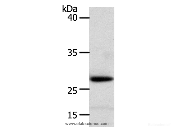 Western Blot analysis of Human liver cancer tissue using RARRES1 Polyclonal Antibody at dilution of 1:300
