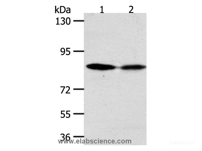 Western Blot analysis of Hela and SKOV3 cell using ADAM11 Polyclonal Antibody at dilution of 1:500