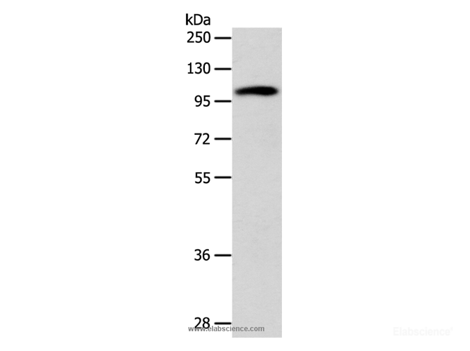 Western Blot analysis of 293T cell using ADCY1 Polyclonal Antibody at dilution of 1:1000