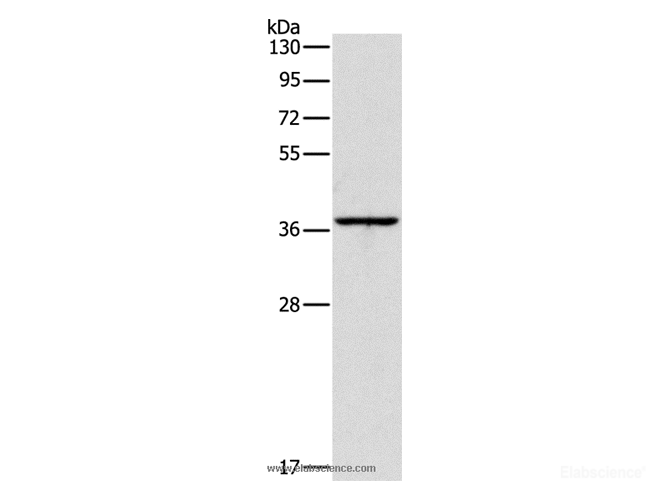 Western Blot analysis of Huvec cell using APOL2 Polyclonal Antibody at dilution of 1:375
