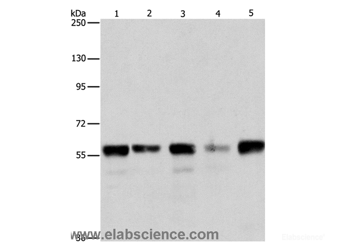 Western Blot analysis of Hela, Jurkat, 293T and K562 cell, Mouse testis tissue using ARIH2 Polyclonal Antibody at dilution of 1:550