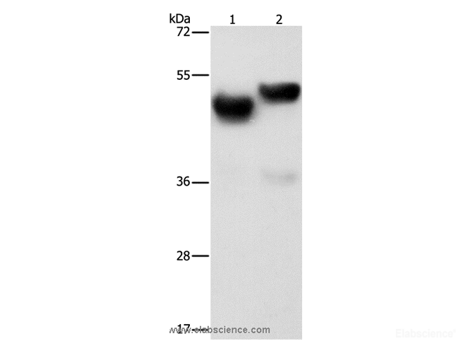 Western Blot analysis of Human fetal brain and liver tissue using AMZ1 Polyclonal Antibody at dilution of 1:1000