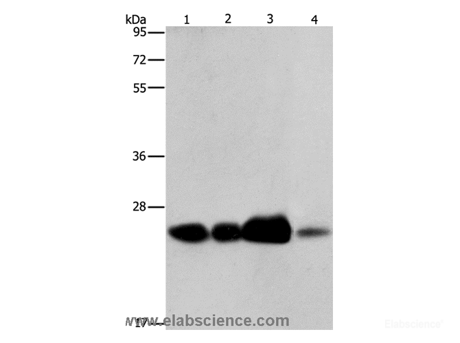 Western Blot analysis of 293T cell and Human fetal liver tissue, Human cervical cancer and fetal muscle tissue using ARFRP1 Polyclonal Antibody at dilution of 1:800