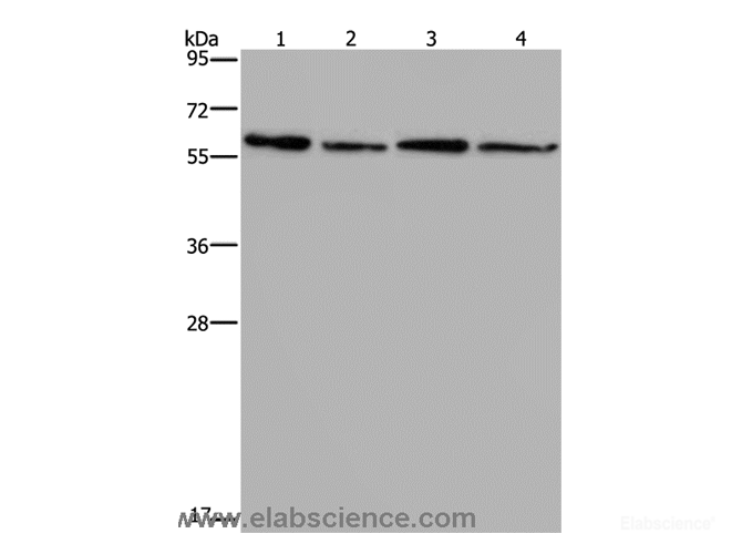 Western Blot analysis of Mouse kidney, liver, heart and brain tissue using CD297 Polyclonal Antibody at dilution of 1:667