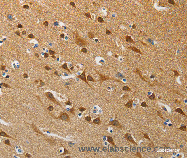 Immunohistochemistry of paraffin-embedded Human brain tissue using ATG4B Polyclonal Antibody at dilution 1:50