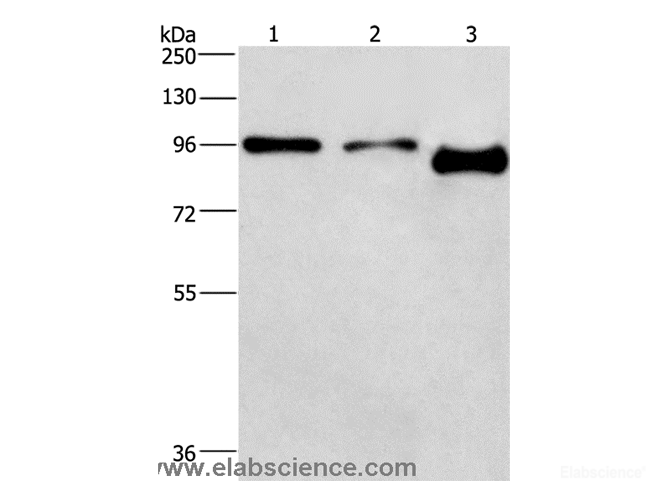 Western Blot analysis of A431 and hela cell,Mouse brain tissue using PIP5K1C Polyclonal Antibody at dilution of 1:500