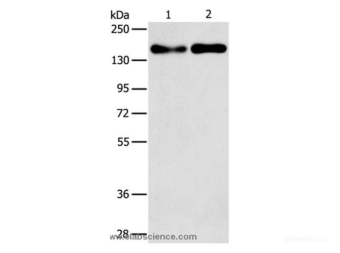 Western Blot analysis of A431 and Huvec cell using THBS1 Polyclonal Antibody at dilution of 1:250