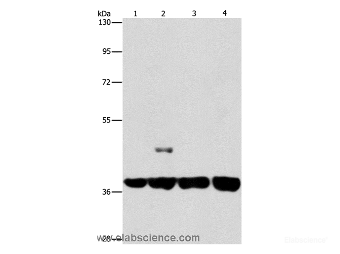 Western Blot analysis of 293T and 231 cell, U937 and Raji cell using SERPINA9 Polyclonal Antibody at dilution of 1:350