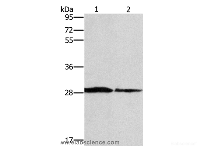 Western Blot analysis of Human chromaffin cell tumor tissue and lovo cell using SPR Polyclonal Antibody at dilution of 1:1500