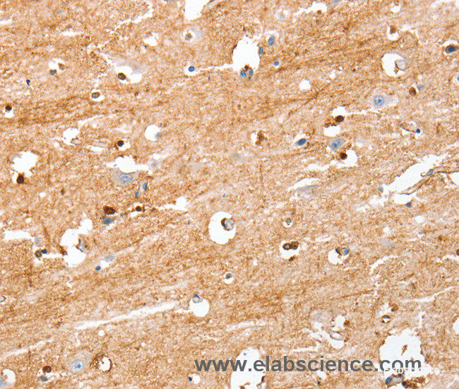 Immunohistochemistry of paraffin-embedded Human brain tissue using S100B Polyclonal Antibody at dilution 1:50