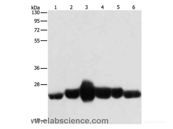 Western Blot analysis of Human fetal muscle and fetal lung tissue, Human leiomyosarcoma tissue, Mouse lung and heart tissue, NIH/3T3 cell using CAV1 Polyclonal Antibody at dilution of 1:550
