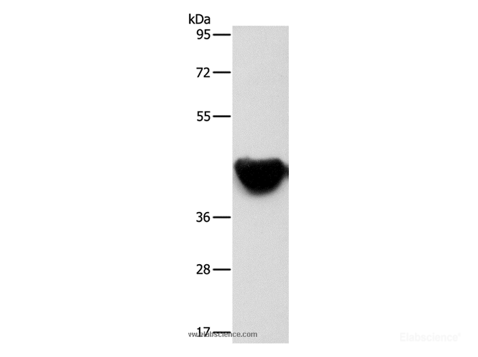 Western Blot analysis of Mouse heart tissue using ACTA2 Polyclonal Antibody at dilution of 1:500