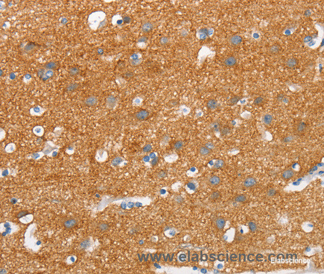 Immunohistochemistry of paraffin-embedded Human brain tissue using SNCA Polyclonal Antibody at dilution 1:30