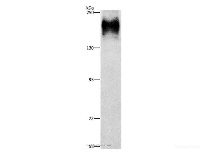 Western Blot analysis of HepG2 cell using ATP7A Polyclonal Antibody at dilution of 1:800