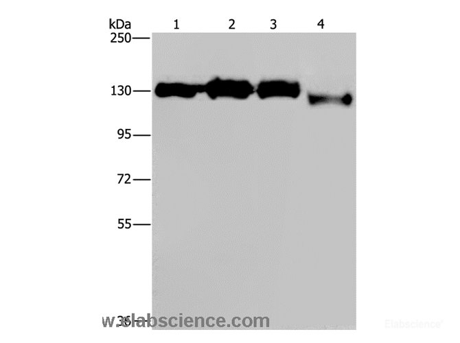 Western Blot analysis of Hela, 293T, Raji and 231 cell using GTF2I Polyclonal Antibody at dilution of 1:400
