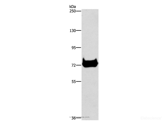 Western Blot analysis of Mouse pancreas tissue using CEL Polyclonal Antibody at dilution of 1:500
