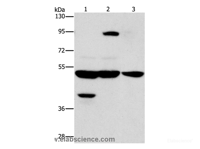 Western Blot analysis of Human bladder carcinoma tissue and A172 cell, Human brain malignant glioma tissue using STK4 Polyclonal Antibody at dilution of 1:1000