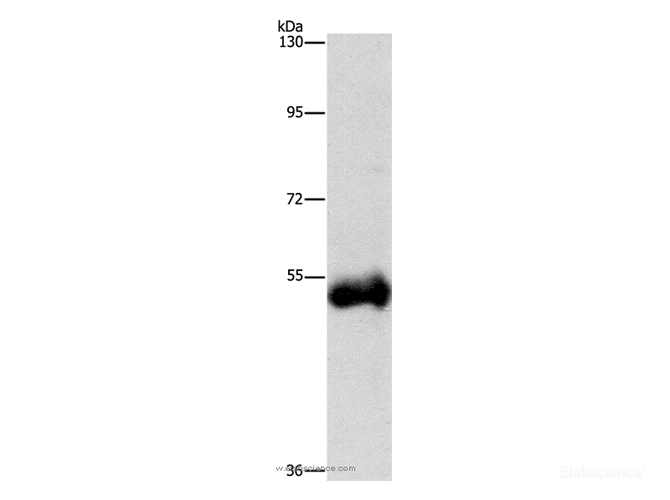 Western Blot analysis of Human placenta tissue using CTSC Polyclonal Antibody at dilution of 1:1000