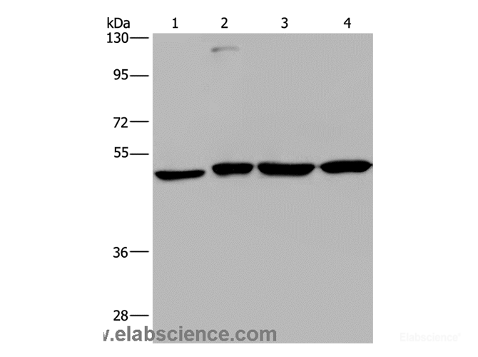 Western Blot analysis of A431, HepG2, Raji and K562 cell using CCR6 Polyclonal Antibody at dilution of 1:966