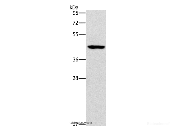 Western Blot analysis of Mouse brain tissue using B3GAT1 Polyclonal Antibody at dilution of 1:400