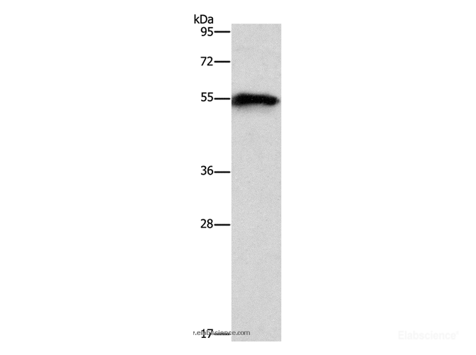 Western Blot analysis of Mouse heart tissue using CDK19 Polyclonal Antibody at dilution of 1:1000