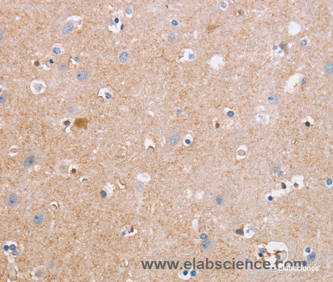 Immunohistochemistry of paraffin-embedded Human brain tissue using CDC7 Polyclonal Antibody at dilution 1:50