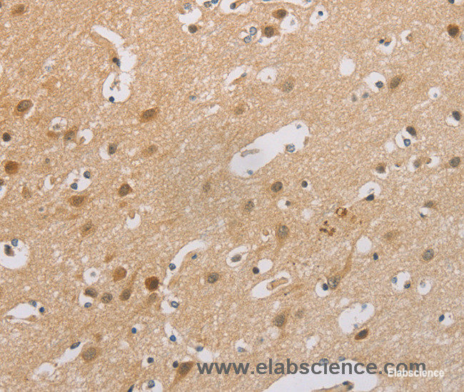 Immunohistochemistry of paraffin-embedded Human brain tissue using p16 Polyclonal Antibody at dilution 1:60
