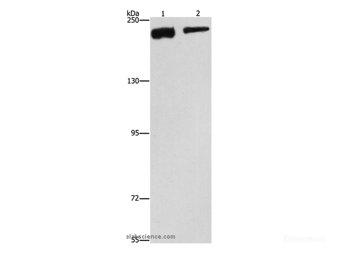 Western Blot analysis of NIH/3T3 and hela cell using CLTC Polyclonal Antibody at dilution of 1:300