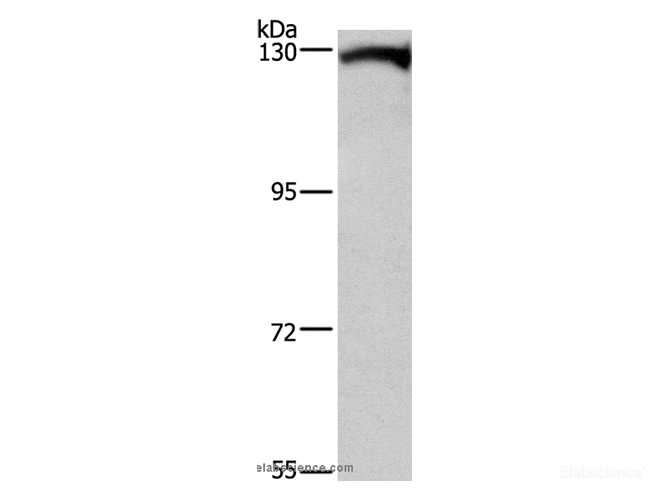 Western Blot analysis of Human testis tissue using DAAM1 Polyclonal Antibody at dilution of 1:400