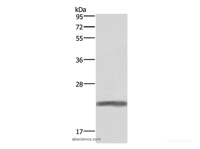Western Blot analysis of Human placenta tissue using GH1 Polyclonal Antibody at dilution of 1:500