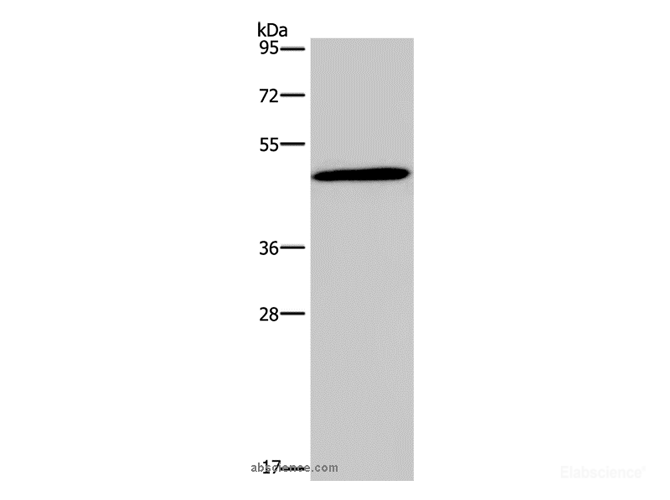Western Blot analysis of 293T cell using Glucagon Receptor Polyclonal Antibody at dilution of 1:200