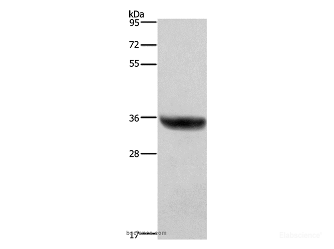 Western Blot analysis of Human placenta tissue using HSD17B1 Polyclonal Antibody at dilution of 1:700