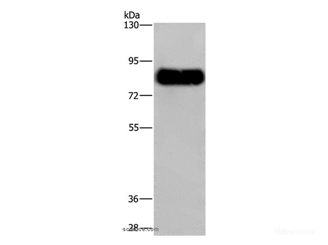 Western Blot analysis of Mouse brain tissue using SYN1 Polyclonal Antibody at dilution of 1:650