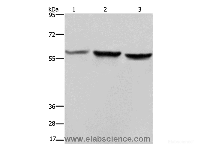 Western Blot analysis of Hela, A375 and LoVo cell using SYN2 Polyclonal Antibody at dilution of 1:1400