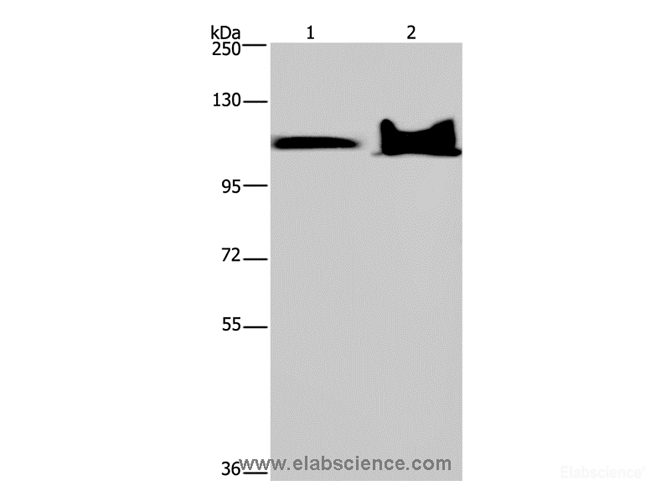 Western Blot analysis of Mouse heart and brain tissue using KDM4C Polyclonal Antibody at dilution of 1:800
