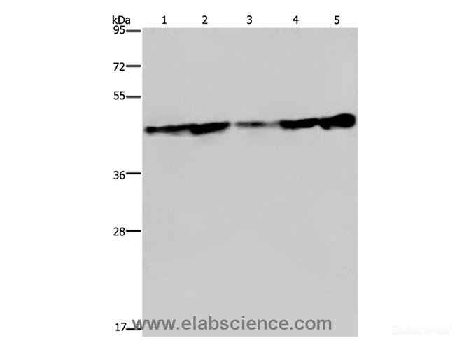 Western Blot analysis of Human fetal liver tissue, HT-29 and HUVEC cell, MCF-7 cell and Human hepatocellular carcinoma tissue using CERS4 Polyclonal Antibody at dilution of 1:300
