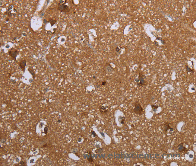 Immunohistochemistry of paraffin-embedded Human brain tissue using LIMK1 Polyclonal Antibody at dilution 1:40