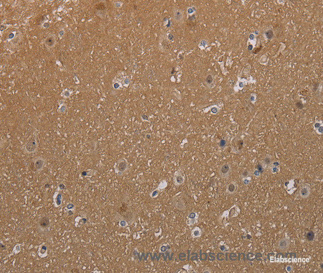 Immunohistochemistry of paraffin-embedded Human brain tissue using MAGEL2 Polyclonal Antibody at dilution 1:40