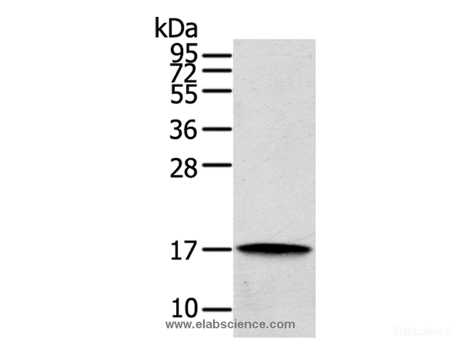 Western Blot analysis of Human cecum carcinoma tissue using REG3A Polyclonal Antibody at dilution of 1:200