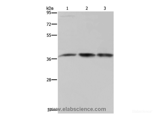Western Blot analysis of 293T and LoVo cell, Human brain malignant glioma tissue using CAB39 Polyclonal Antibody at dilution of 1:450