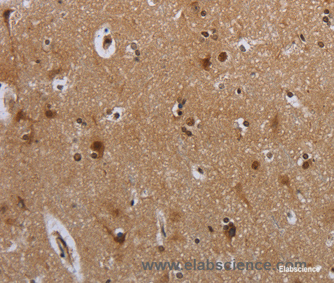 Immunohistochemistry of paraffin-embedded Human brain tissue using MTBP Polyclonal Antibody at dilution 1:40