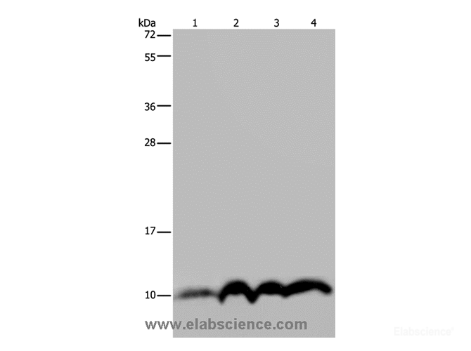 Western Blot analysis of SKOV3 cell and Human fetal liver tissue, Human fetal brain tissue and Hela cell using NDUFA4 Polyclonal Antibody at dilution of 1:300