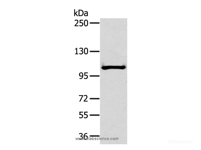 Western Blot analysis of Mouse liver tissue using NPR2 Polyclonal Antibody at dilution of 1:300